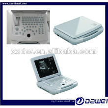 China laptop human ultrasound scanner system gynecological kit(DW500)